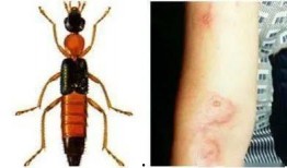 昆虫学者皮肤最新爆料,皮肤奥秘新发现